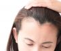 Hairstyles For Women With Receding Hairline